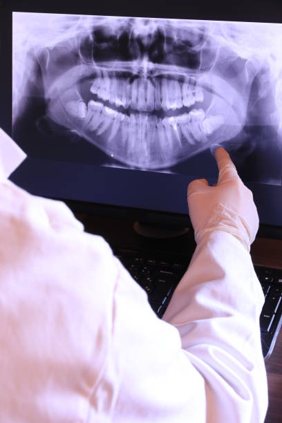 Best Emergency Root Canal Treatment in Itasca, IL