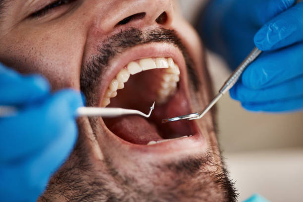 Best Emergency Dentist for Special Needs Patients in Itasca, IL